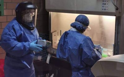 Continúan analizando posible caso de viruela simica en el Istmo