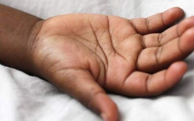 Confirma SSO muerte de paciente tras complicaciones a la salud por mordedura de fauna silvestre