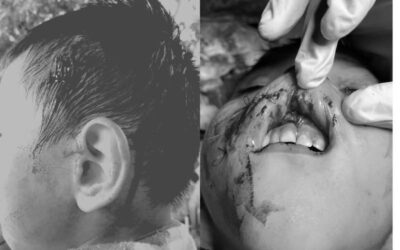 Perro ataca a menor de edad en Cuilapam de Guerrero